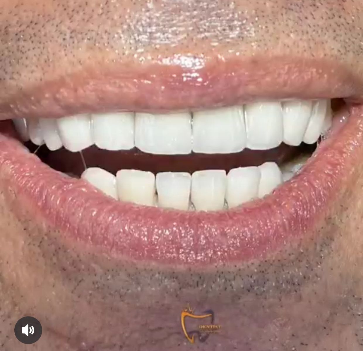 بهترین دکتر لمینت دندان در کرمانشاه