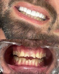 کامپوزیت ارزان کرمانشاه