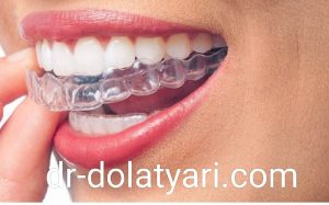 ارتودنس نامرئی در کرمانشاه