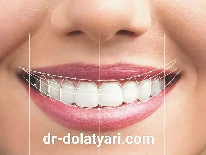 دندانپزشکی زیبایی در کرمانشاه