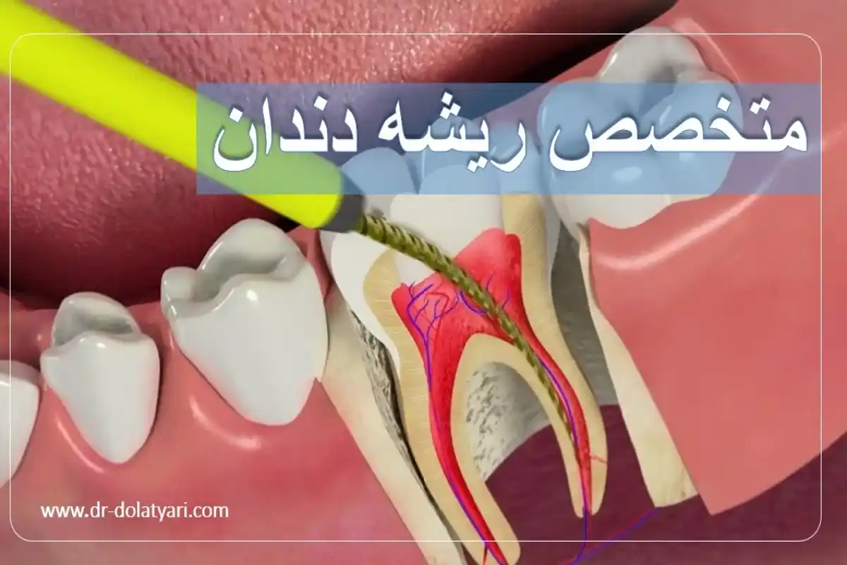 متخصص ریشه دندان
