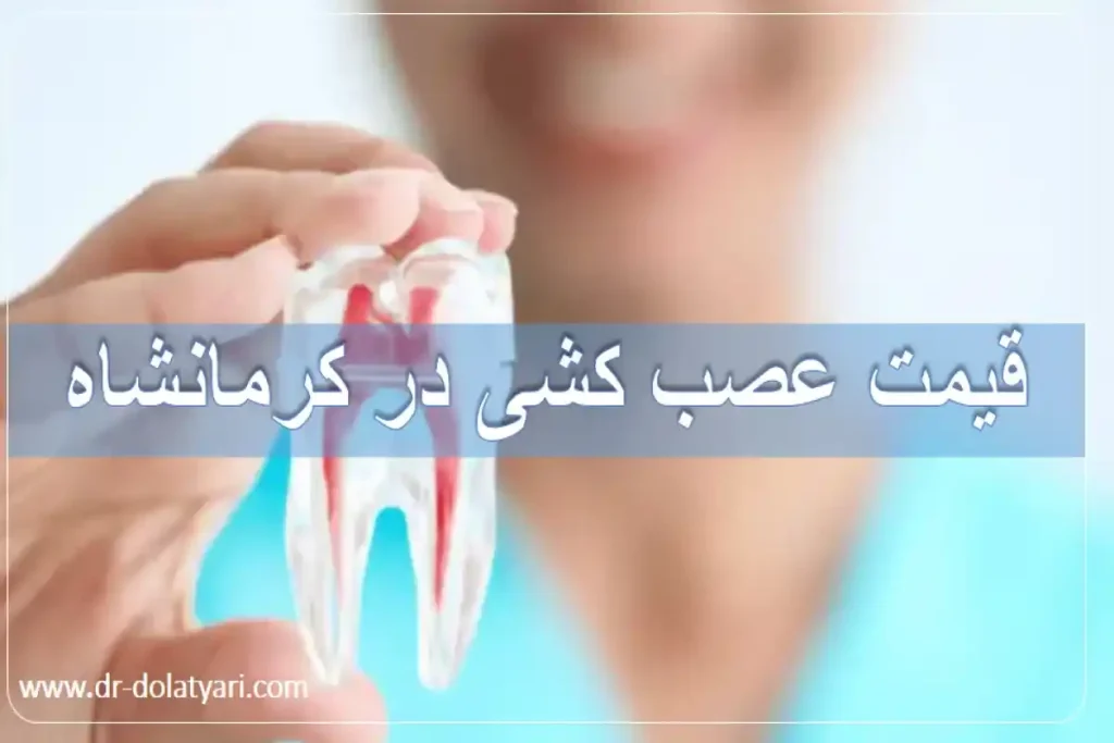 قیمت عصب کشی در کرمانشاه