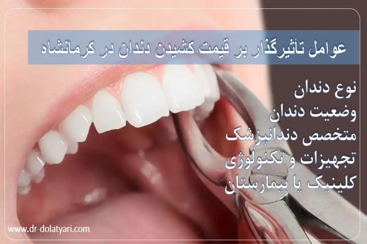 عوامل تأثیرگذار بر قیمت کشیدن دندان در کرمانشاه