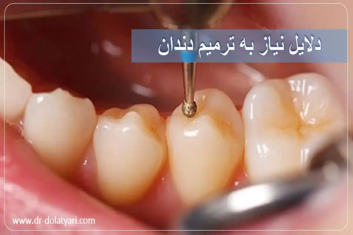 دلایل نیاز به ترمیم دندان