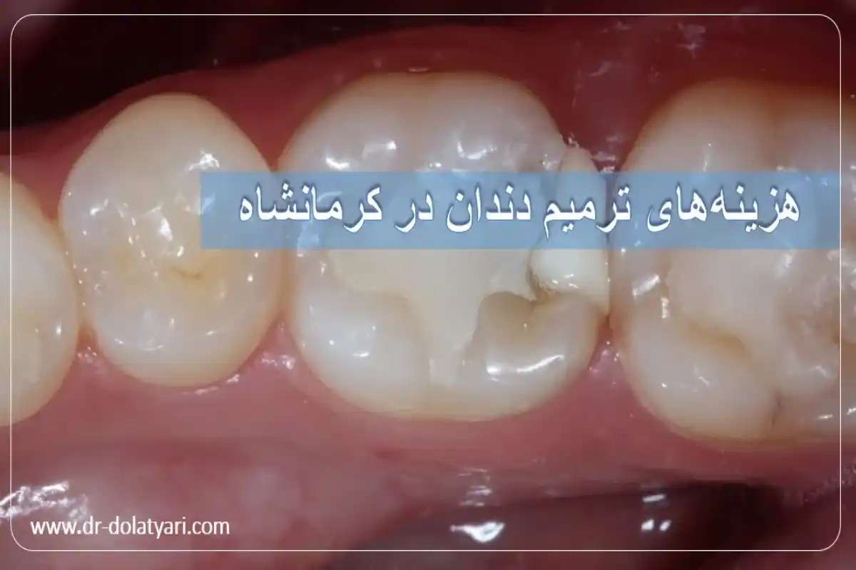 هزینههای ترمیم دندان در کرمانشاه