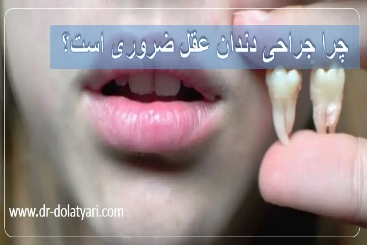 چرا جراحی دندان عقل ضروری است؟