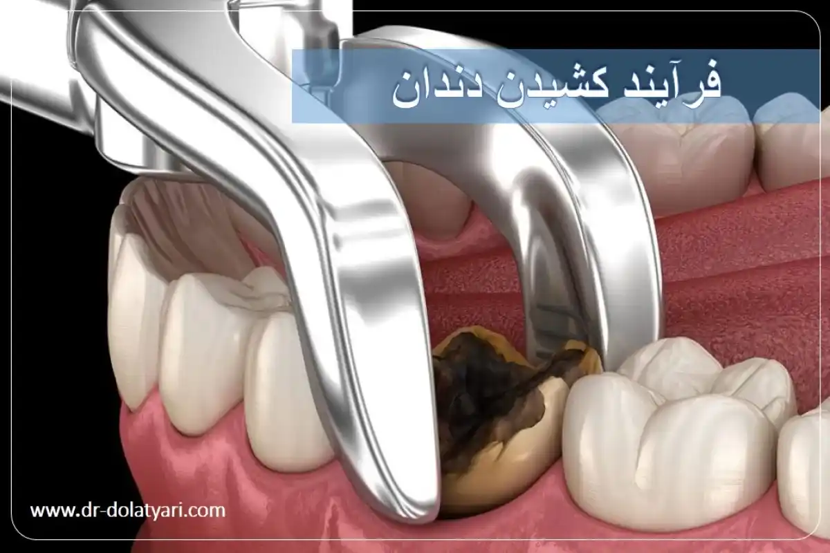 خدمات دندانپزشکی در کرمانشاه