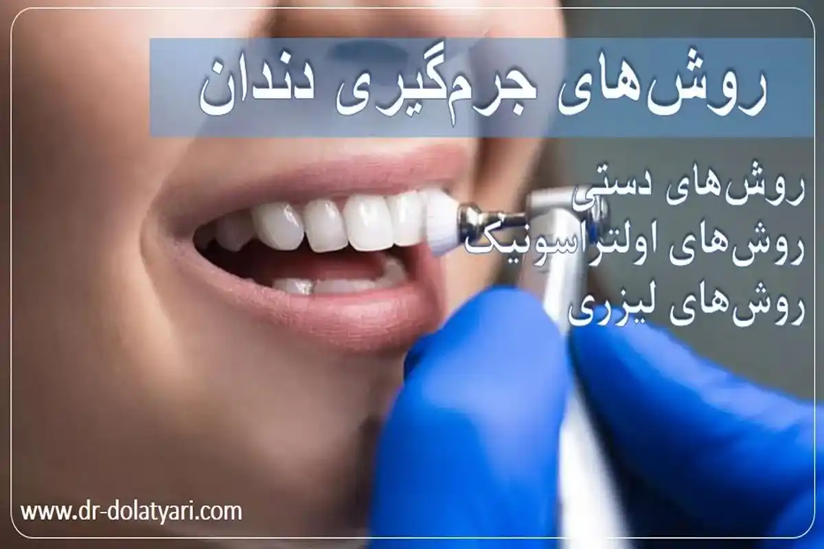 روشهای جرمگیری دندان