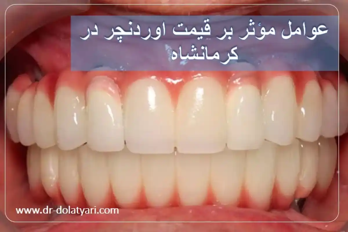 عوامل مؤثر بر قیمت اوردنچر در کرمانشاه