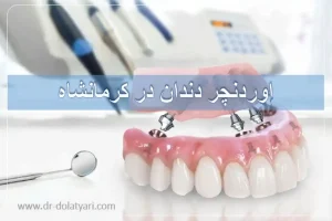 اوردنچر دندان در کرمانشاه
