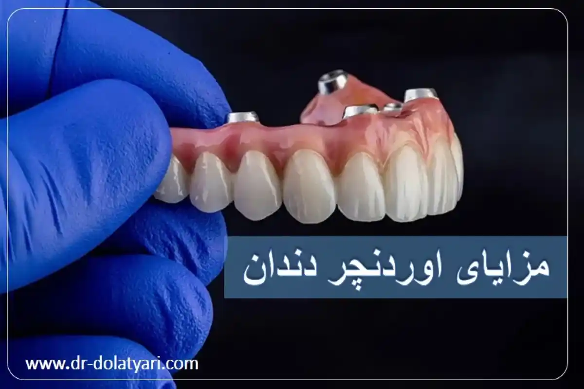 مزایای اوردنچر دندان
