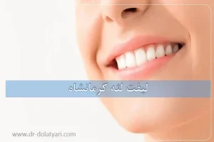 لیفت لثه کرمانشاه