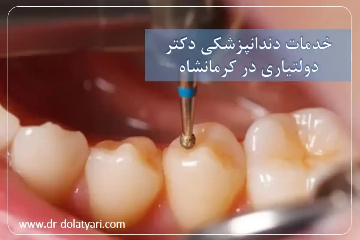 خدمات دندانپزشکی دکتر دولتیاری در کرمانشاه