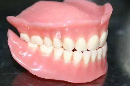 انجام دندان مصنوعی در کرمانشاه