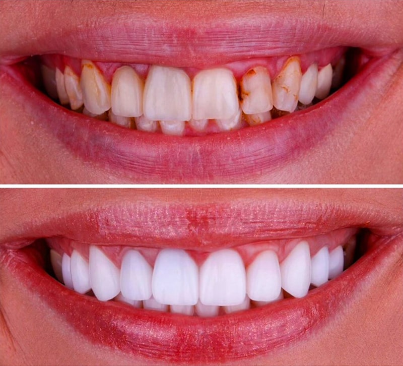 استحکام کامپوزیت در برابر ضریه 