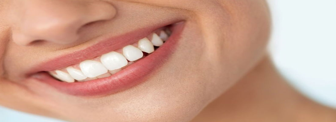 کامپوزیت لثه