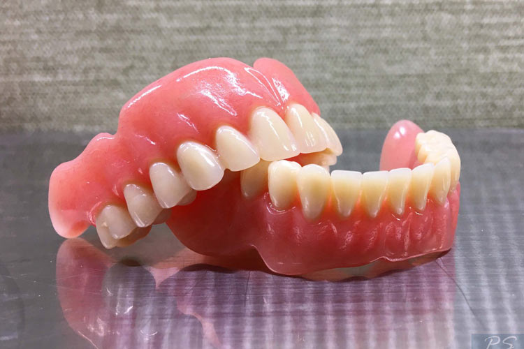 Cost of making dentures in Kermanshah