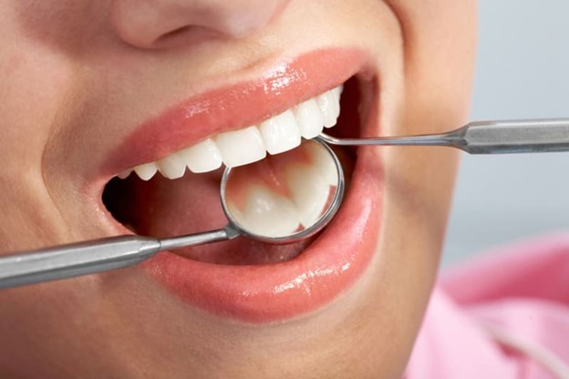 Dental Composite in Islamabad West