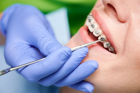 One-day orthodontics in Islamabad West