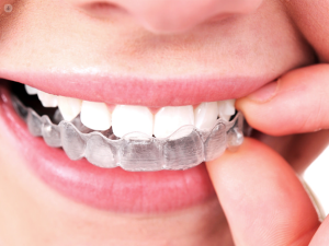 Transparent (invisible) orthodontics in Islamabad West