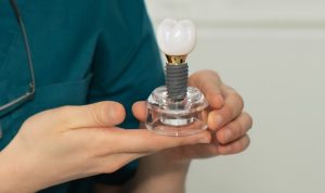 Urgent Implants in Islamabad