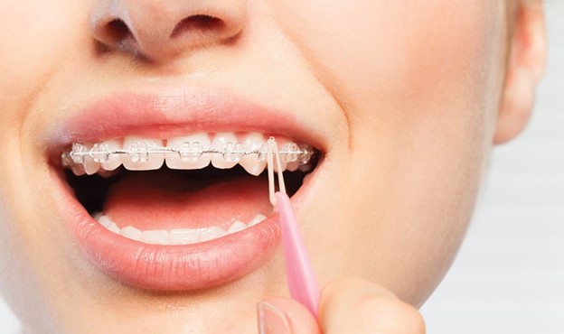 Urgent (one-day) orthodontics in Islamabad West
