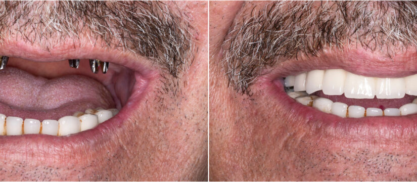 متخصص ایمپلنت در هرسین کرمانشاه