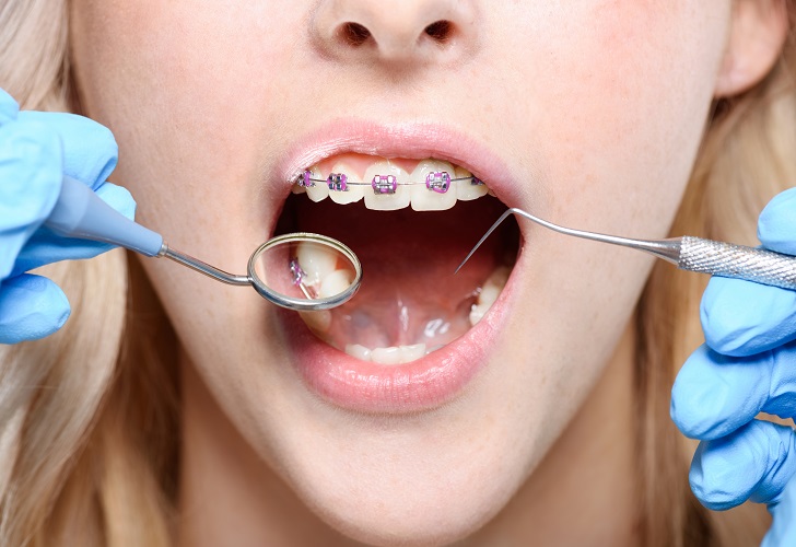 خدمات دندانپزشکی طرف قرارداد با بیمه تکمیلی در هرسین