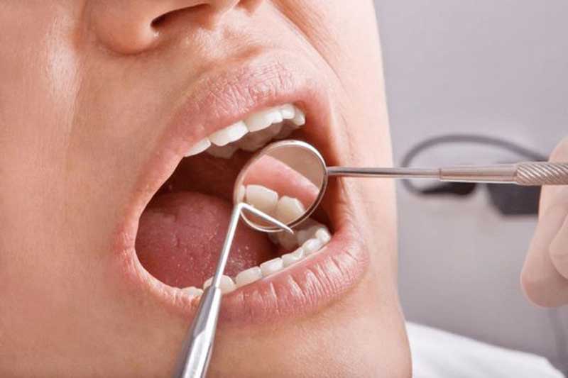 عصب کشی دندان در هرسین