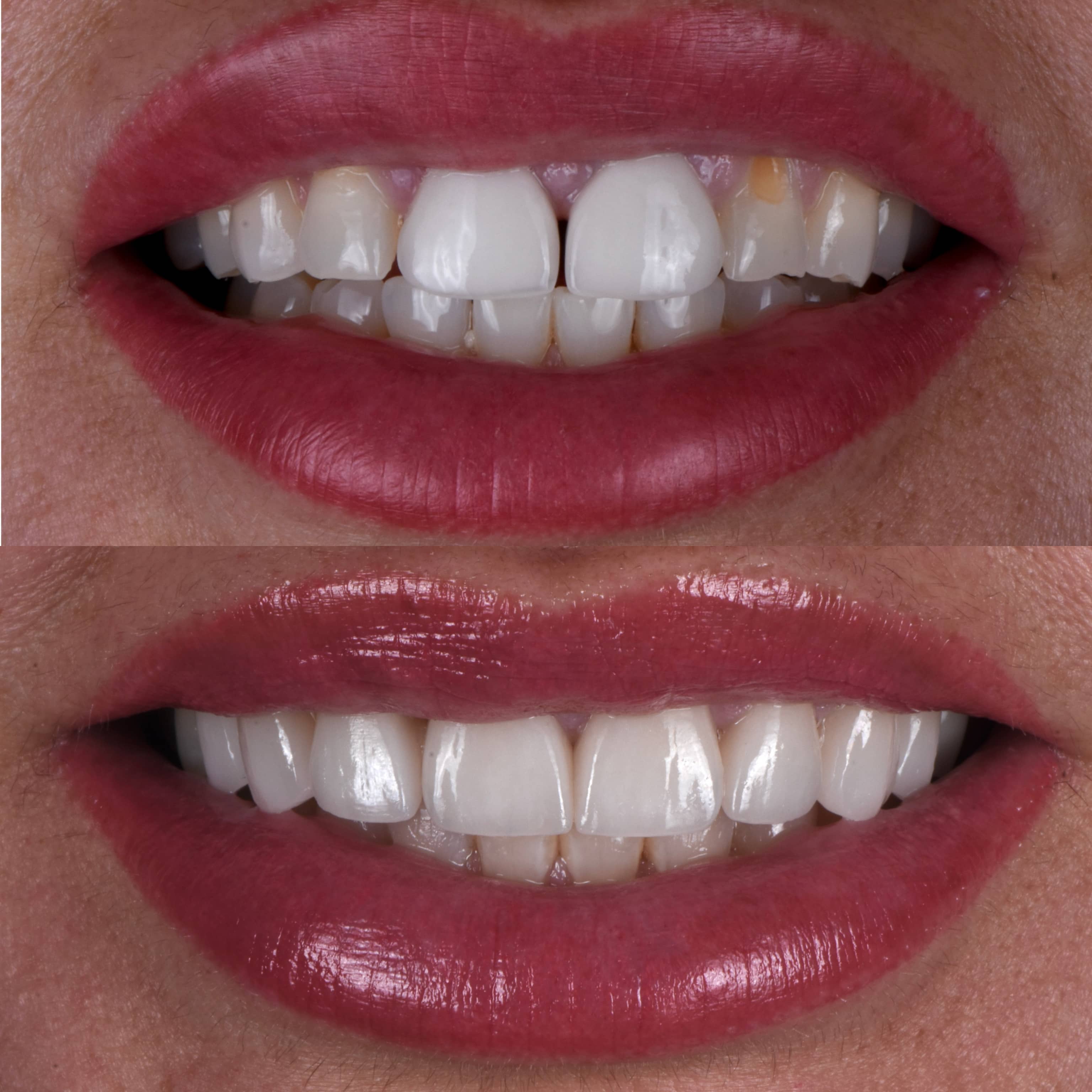 متخصص لمینت در هرسین