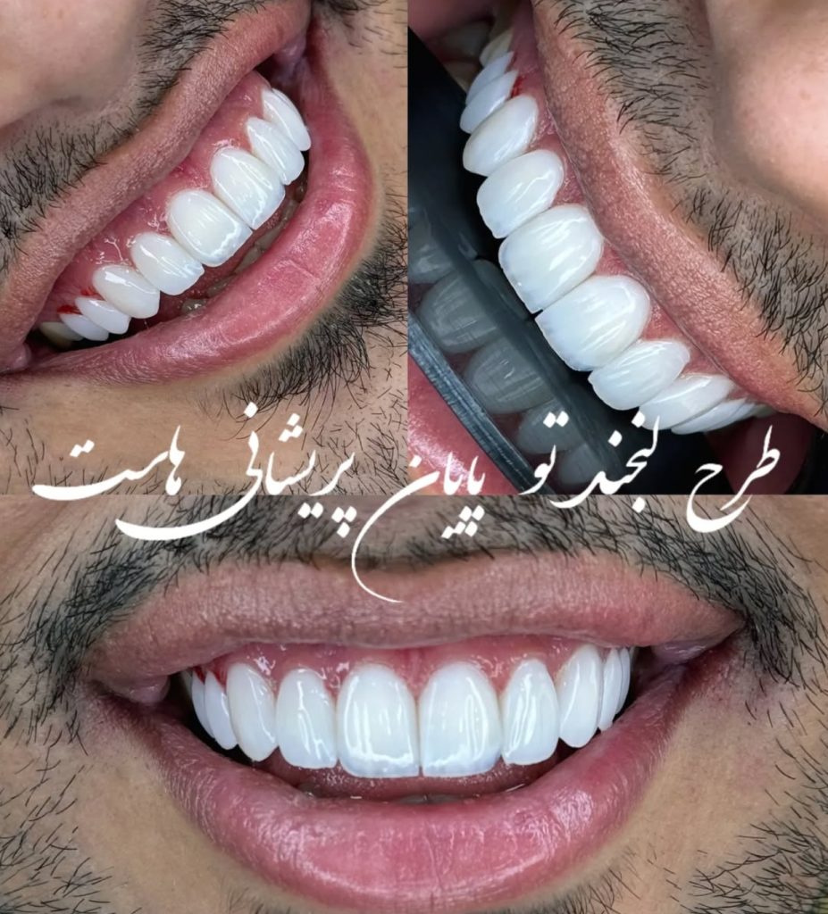 نمونه کار دندانپزشکی در کرمانشاه