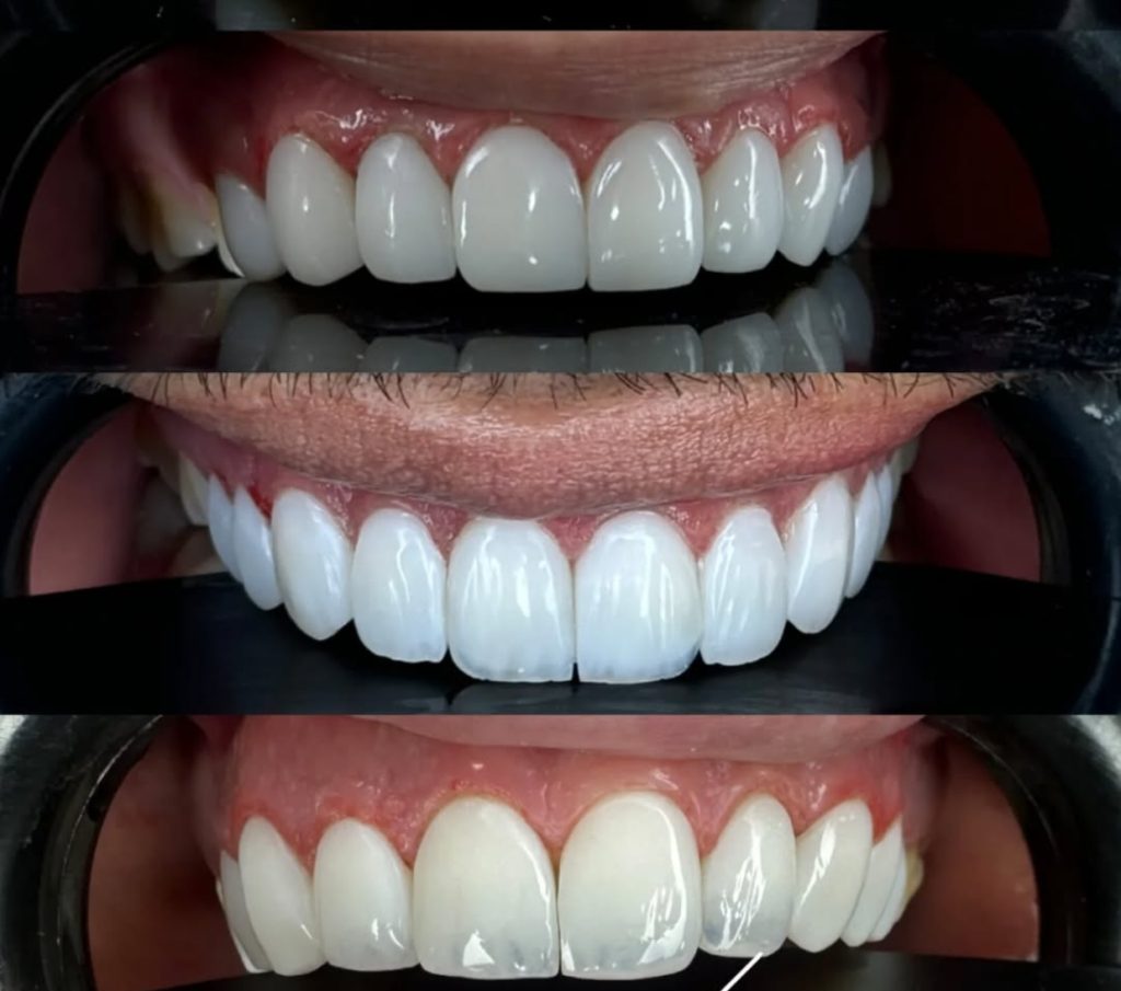 نمونه کار دندانپزشکی در کرمانشاه