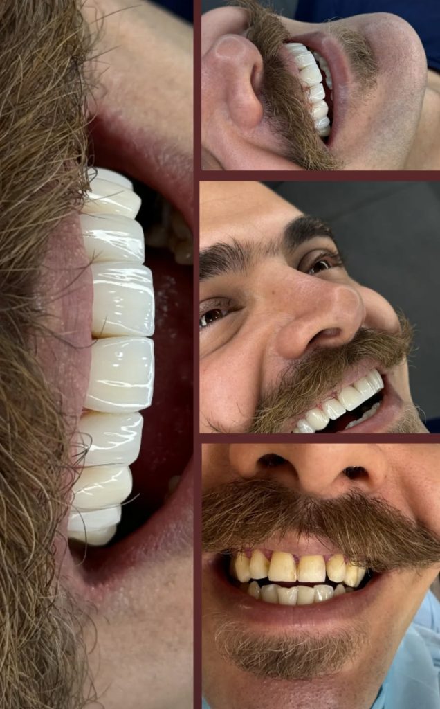 نمونه کار دندانپزشکی در کرمانشاه