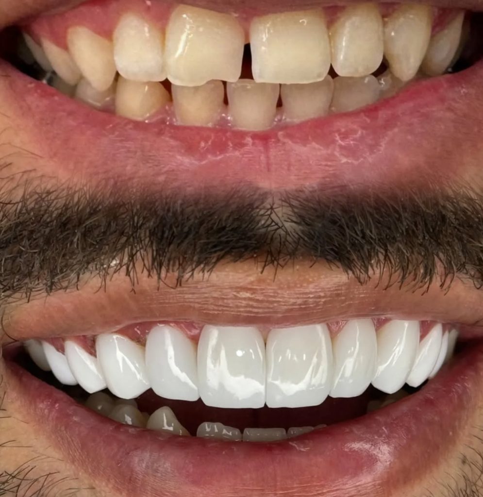 نمونه کار دندانپزشکی در کرمانشاه