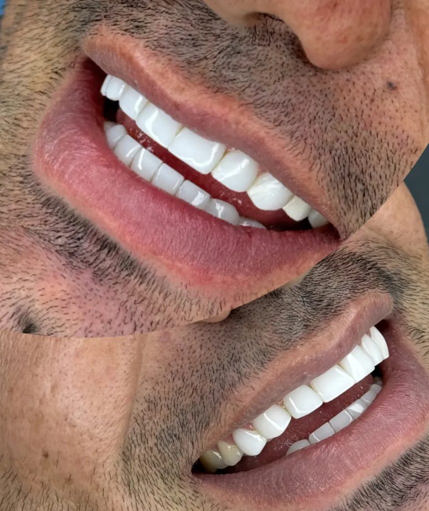 نمونه کار دندانپزشکی در کرمانشاه