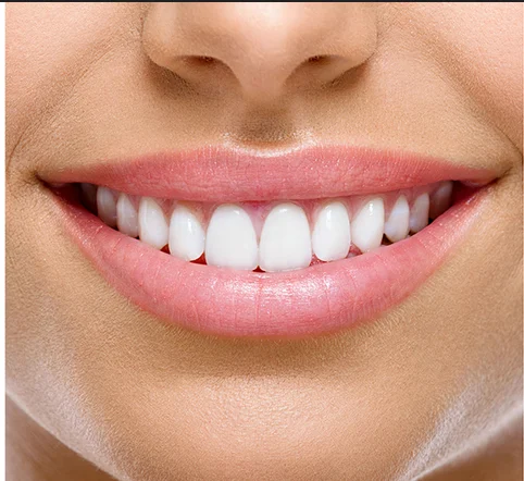 ایمپلنت دیجیتال برای چه افرادی مناسب است