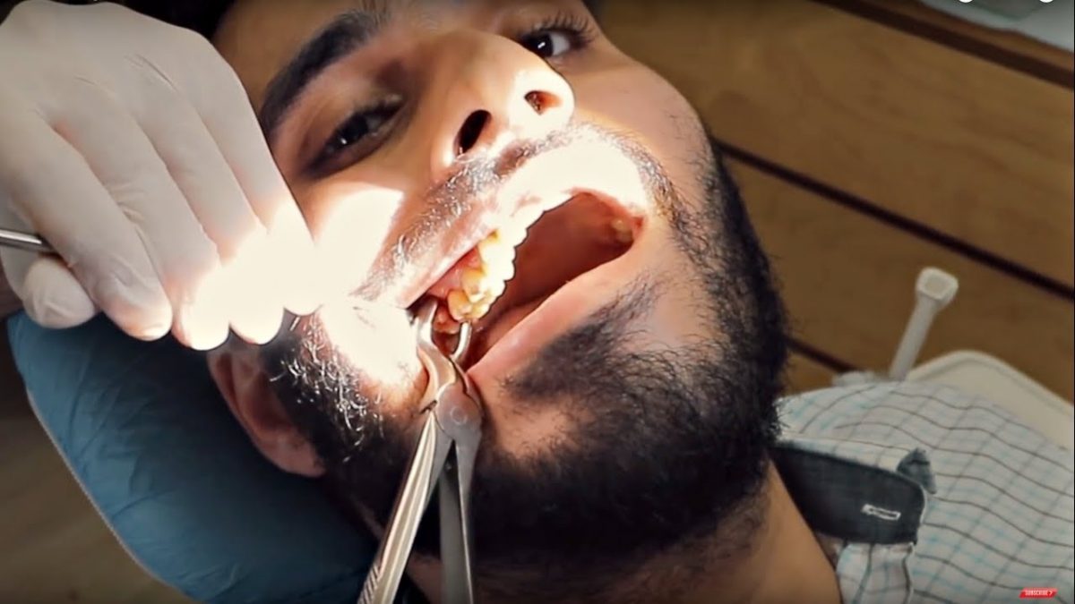 جراحی دندان عقل نهفته و نیمه نهفته در جوانرود