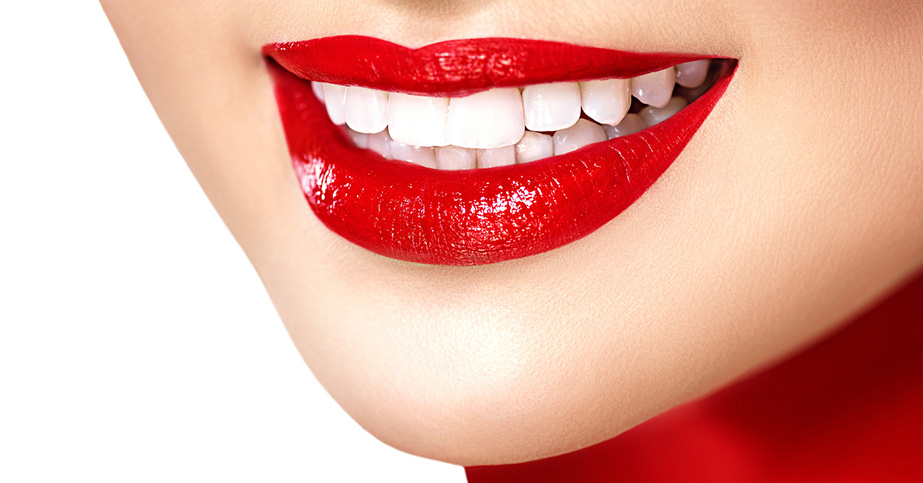 مراحل انجام لمینت دندان چگونه است