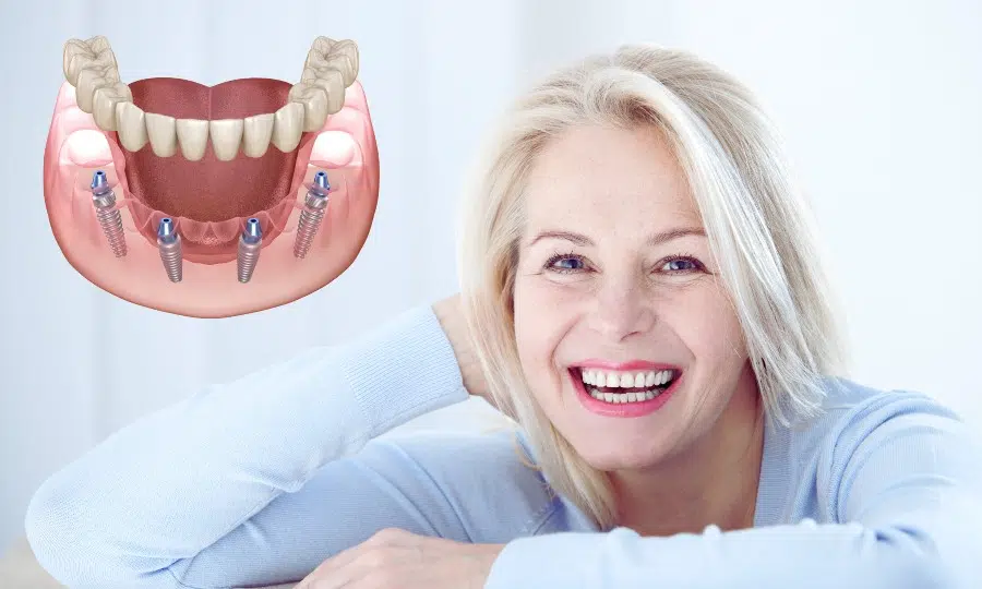 مزایای استفاده از ایمپلنت دیجیتال در جوانرود