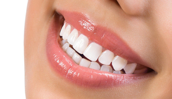 چه خدماتی تحت پوشش دندانپزشکی ارزان و اقساطی در پاوه هستند