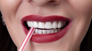 کامپوزیت اقساطی در گیلانغرب