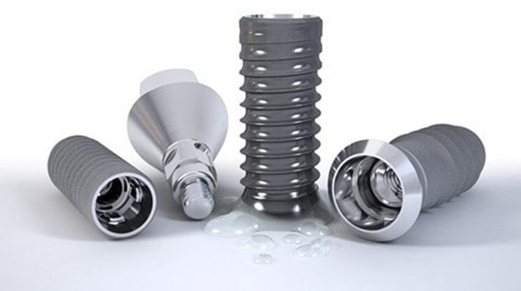 ایمپلنت اقساطی و ارزان در گیلانغرب