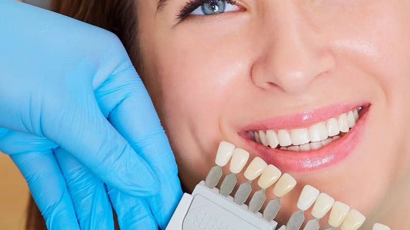 چرا کامپوزیت اقساطی در گیلانغرب این‌همه طرفدار دارد