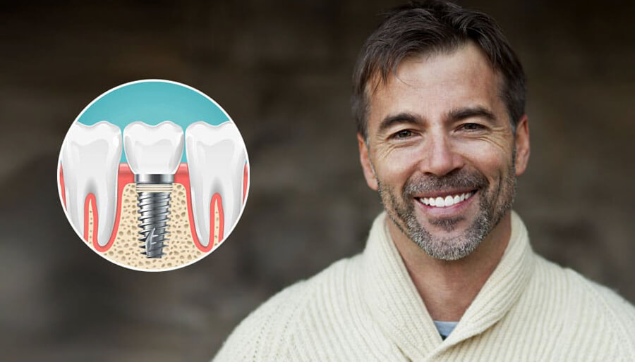 چه کسانی کاندید مناسب ایمپلنت فوری در گیلانغرب هستند